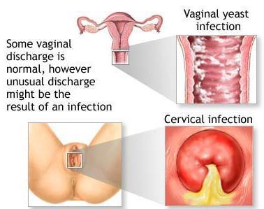 vagina sex