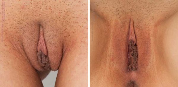 hairy asian vaginas