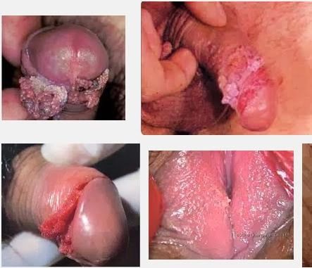 miley cyrus vagina slip