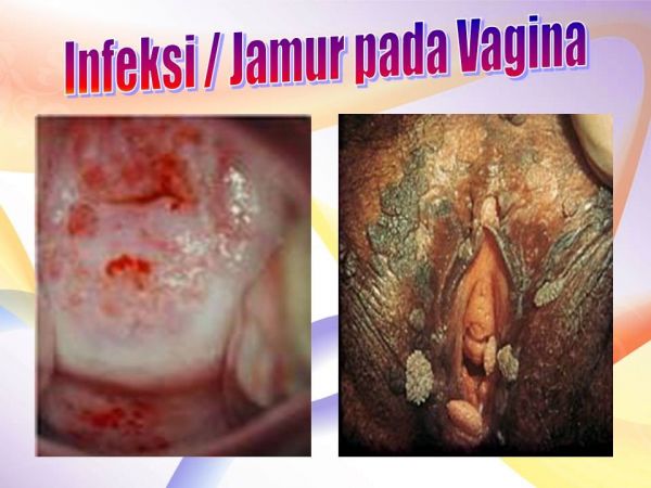 vagina basah