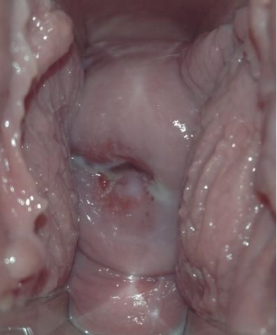 what do vaginas look like