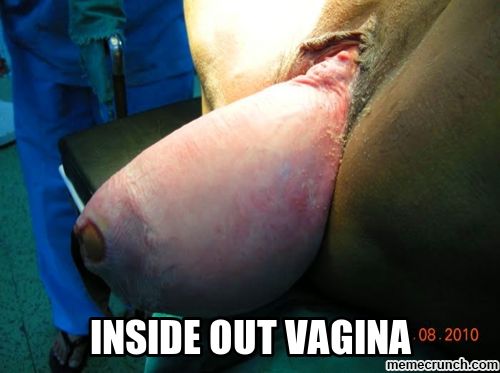 normal vagina